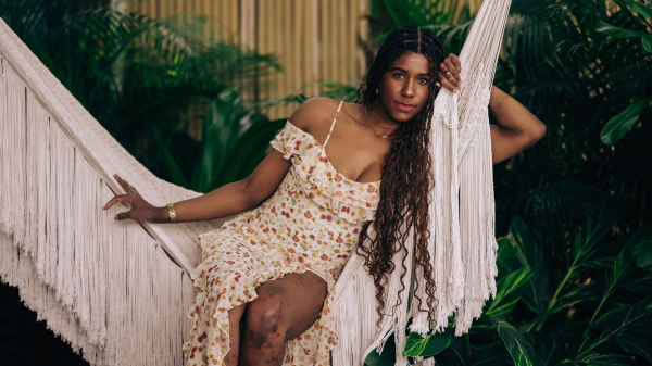 How One Woman Turned Her Battle With Eczema Into a Lifeline for Others